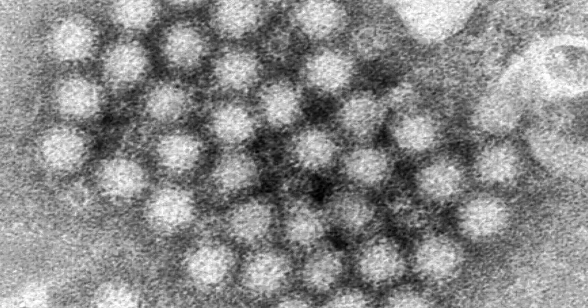 Norovirus Cases Surge Across the US: Outbreaks and Prevention